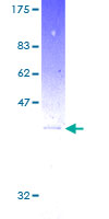 12.5% SDS-PAGE Stained with Coomassie Blue.
